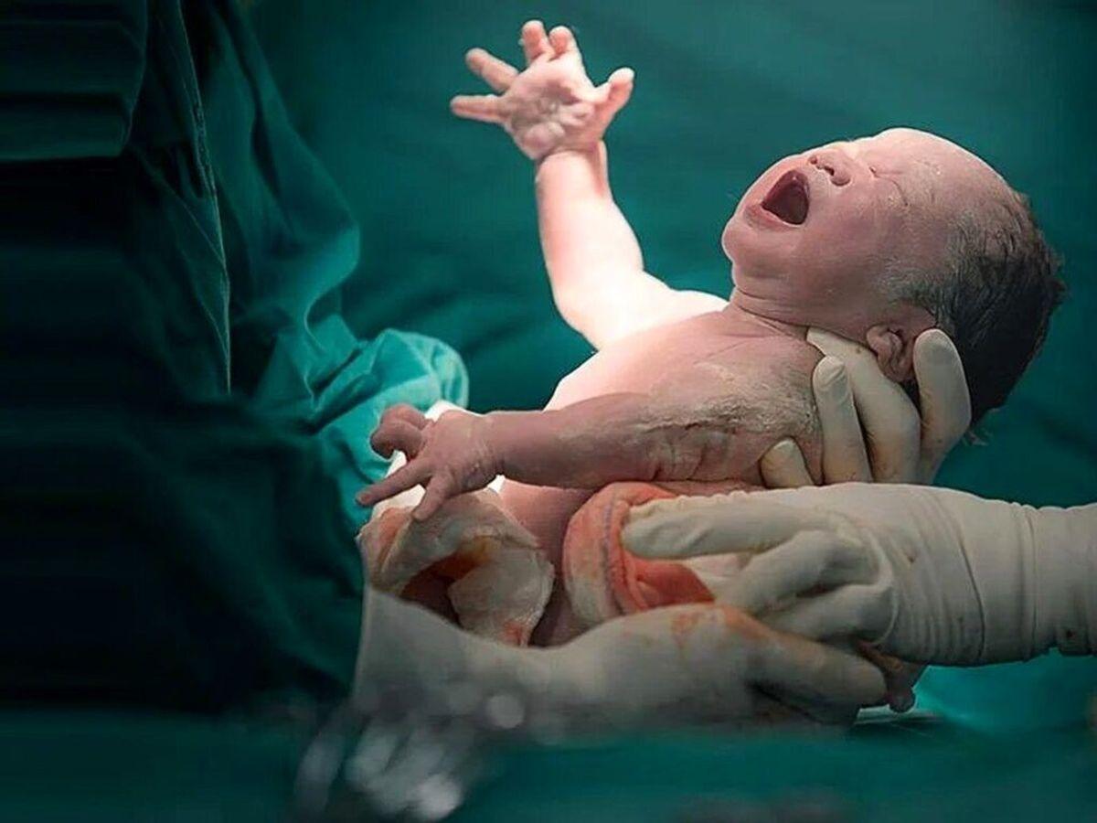 دکتر ماهر نوزاد مرده را زنده کرد | ویدئوی احساسی از لحظه زنده شدن نوزادی که مرده به دنیا آمد
